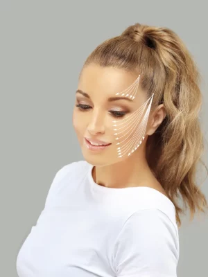 Woman smiling with facial lifting guide arrows drawn on her skin, representing Wrinkle Relaxers services at Evolve HRT & Wellness in The Woodlands, TX.